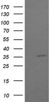 TBCC Antibody