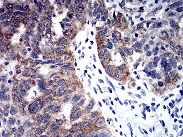TBCC Antibody