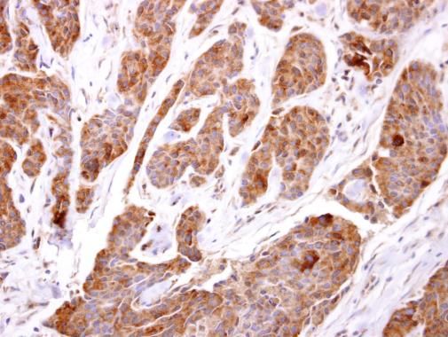 TBCC antibody [N1C3]