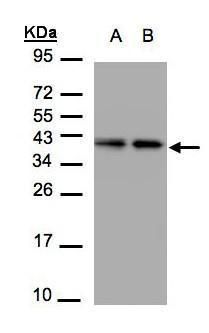 TBCC Rabbit Polyclonal Antibody