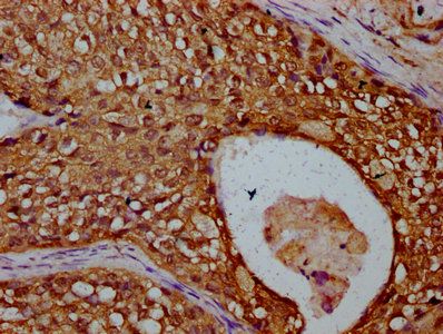 TBCD Antibody