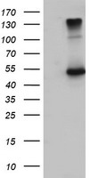 TBCEL Antibody