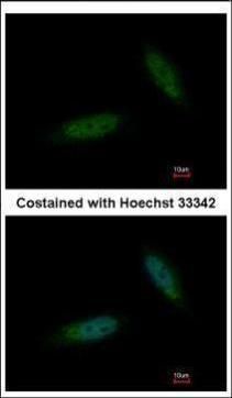 TBCK antibody [C1C2], Internal