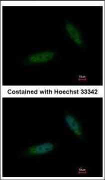 TBCK antibody