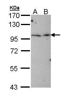 TBCK Rabbit Polyclonal Antibody