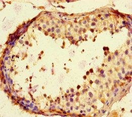 TBK1 Antibody
