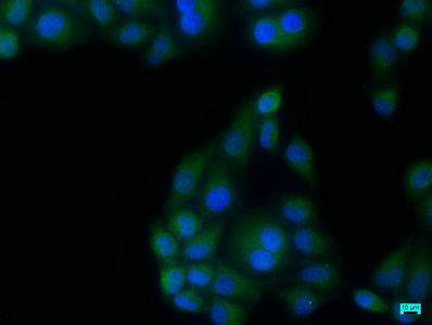 TBK1 Antibody