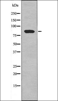TBK1 (Phospho-Ser172) antibody