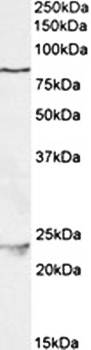 Goat anti-TBK1 (aa514-527) Antibody