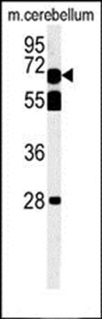 TBKB1 antibody