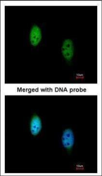 TBLR1 Rabbit Polyclonal Antibody