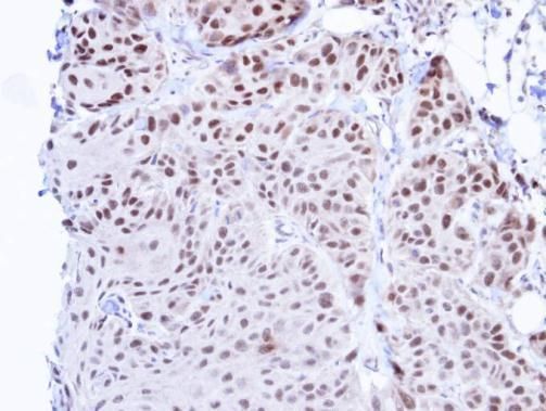 TBLR1 Rabbit Polyclonal Antibody