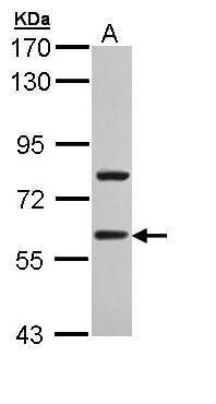 TBLR1 Rabbit Polyclonal Antibody