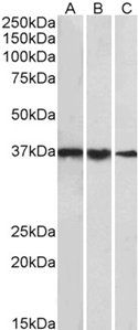Goat anti-TBP /Transcription factor IID (aa39-50) Antibody