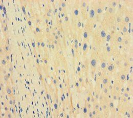 TBPL1 Antibody