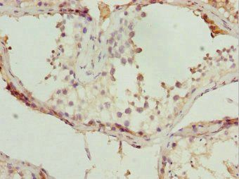 TBPL1 Antibody