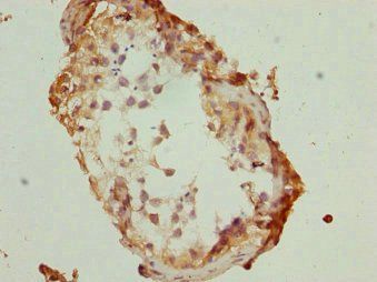TBPL1 Antibody