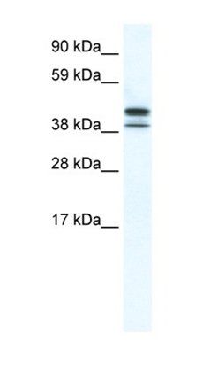 Tbpl2 antibody