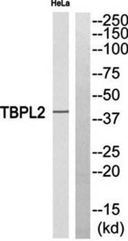 TBPL2 antibody