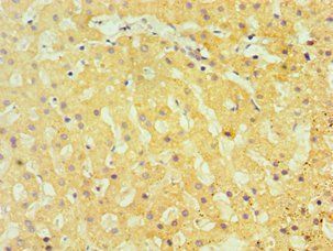 TBRG1 Antibody