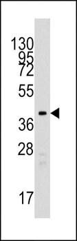 TBRG1 antibody