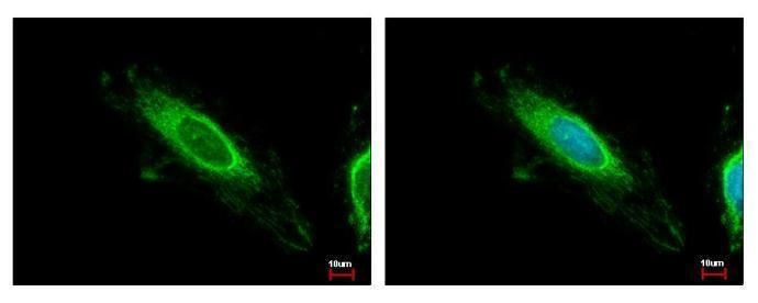 TBRG4 Rabbit Polyclonal Antibody