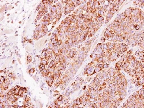 TBRG4 Rabbit Polyclonal Antibody