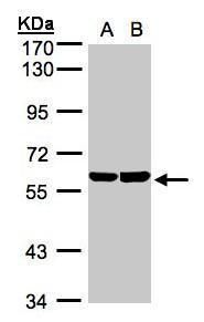 TBRG4 Rabbit Polyclonal Antibody