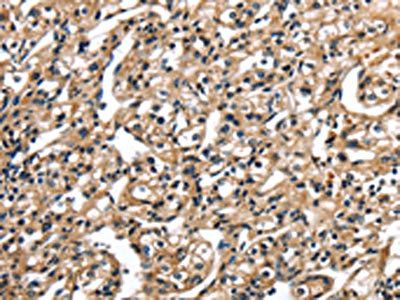 TBX10 Antibody