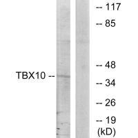 TBX10 antibody