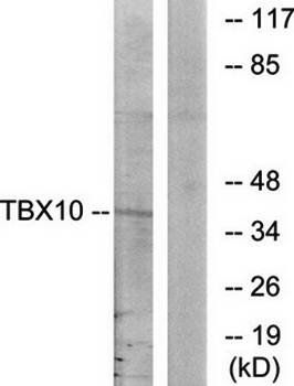 TBX10 Antibody