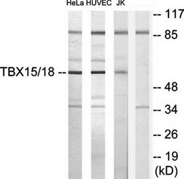 TBX15/18 Antibody