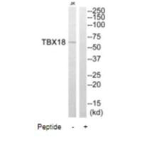 TBX18 antibody