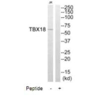 TBX18 Antibody