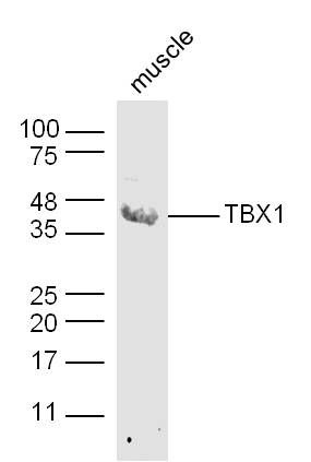 TBX1 antibody