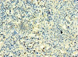 TBX22 Antibody