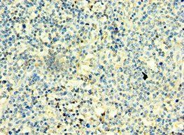 TBX22 antibody