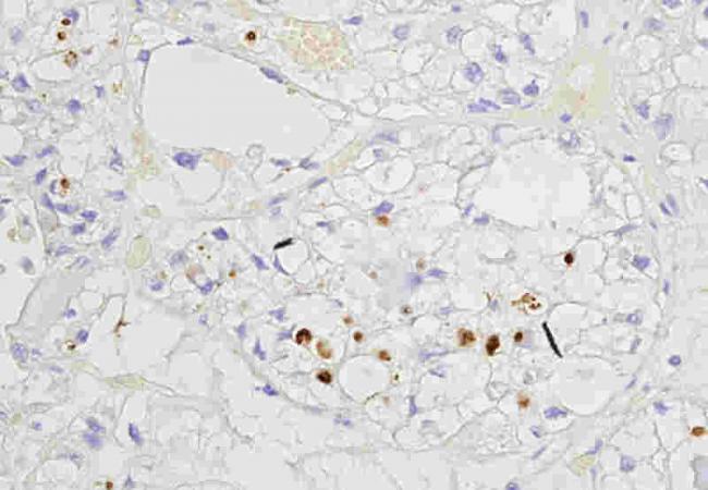 TBX2 Rabbit Polyclonal Antibody