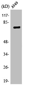 TBX3 antibody