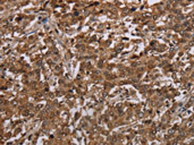 TBX5 Antibody