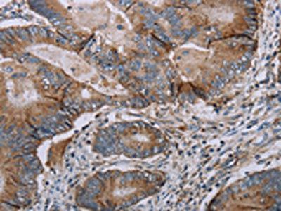 TBX5 Antibody