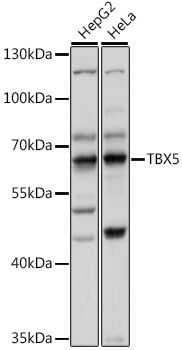 TBX5 antibody