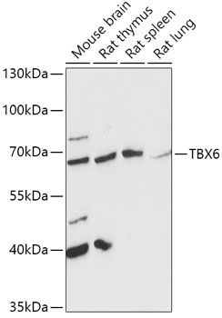 TBX6 antibody
