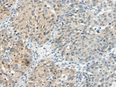 TBXA2R Antibody