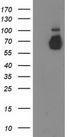 TBXAS1 Antibody