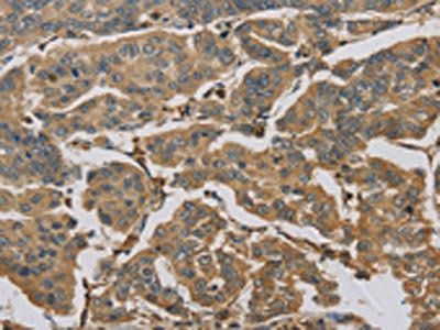 TBXAS1 Antibody
