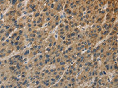 TBXAS1 Antibody