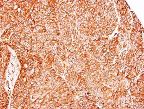 TC21 Rabbit Polyclonal Antibody