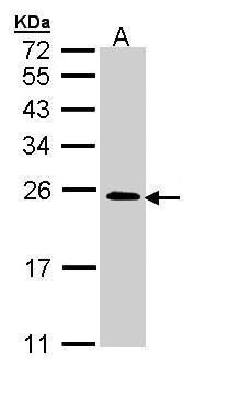 TC21 Rabbit Polyclonal Antibody