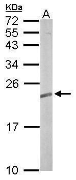 TC21 Rabbit Polyclonal Antibody